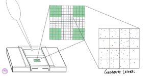 Recuento de Leucocitos - Cámara de Neubauer